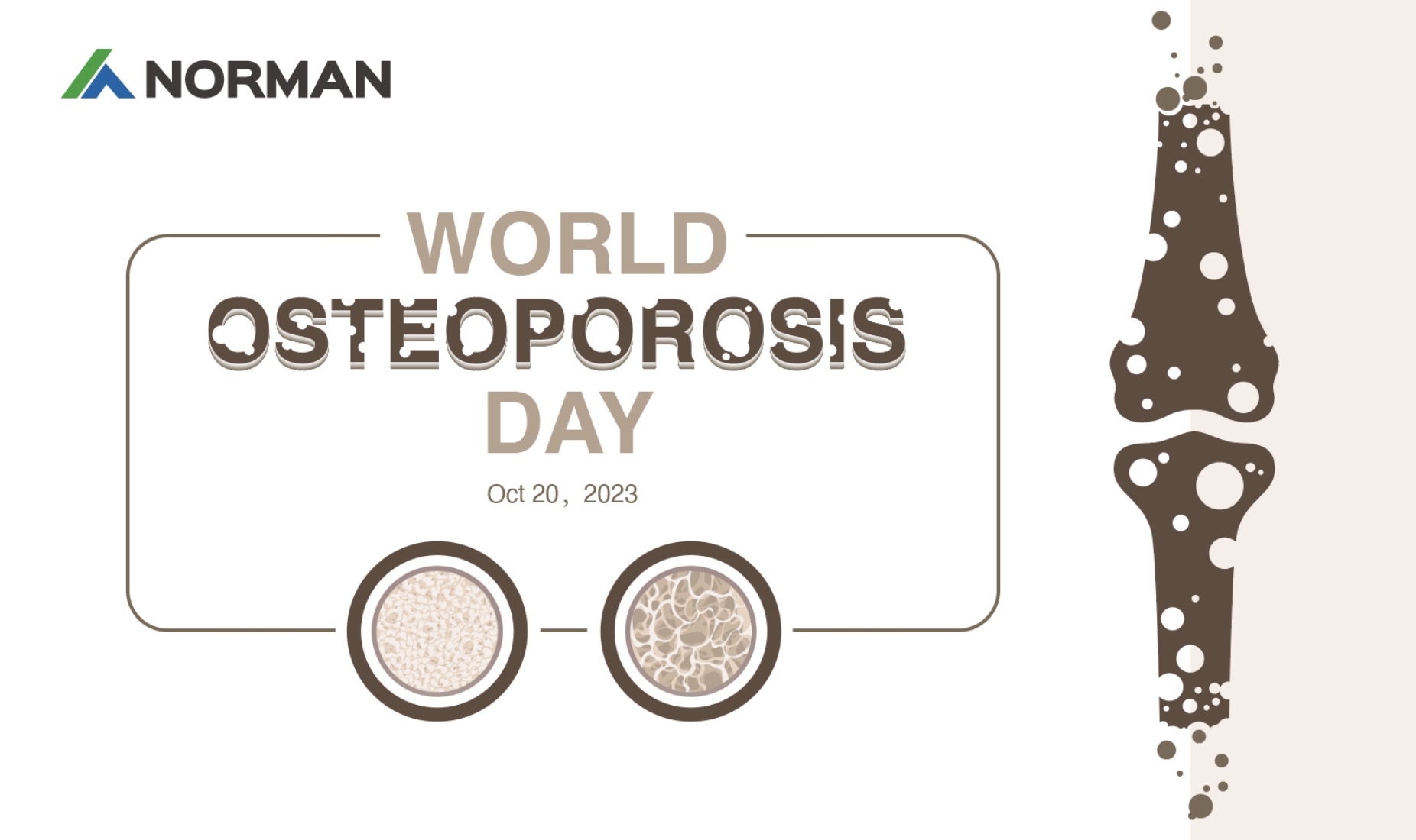 World Osteoporosis Day