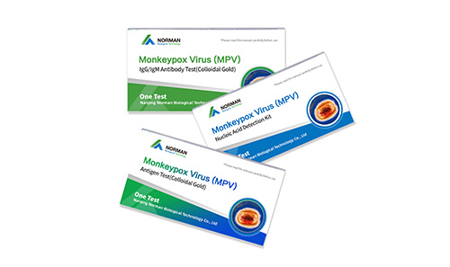 Notification in Spain for Monkeypox Virus Antibody Test Kit