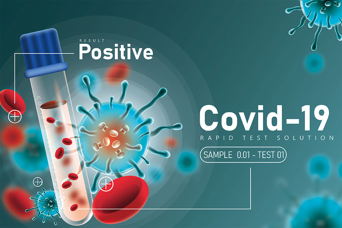 About SARS-CoV-2 (COVID-19) testing